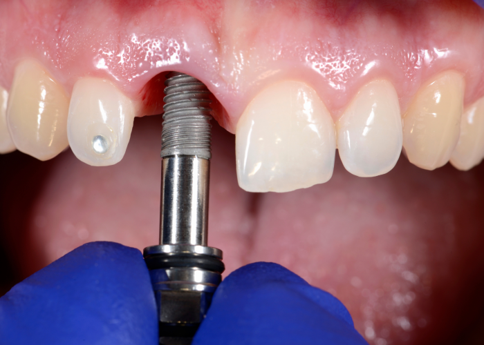 Periodontia (2)