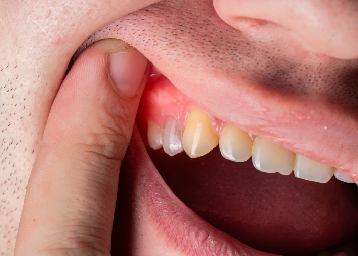 Periodontia